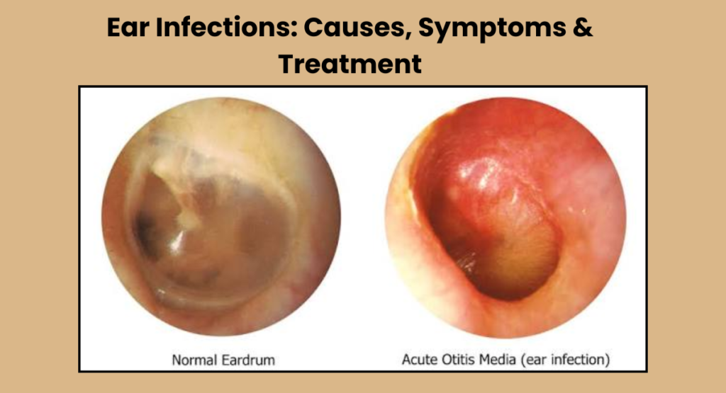 Ear Doctor in Indore