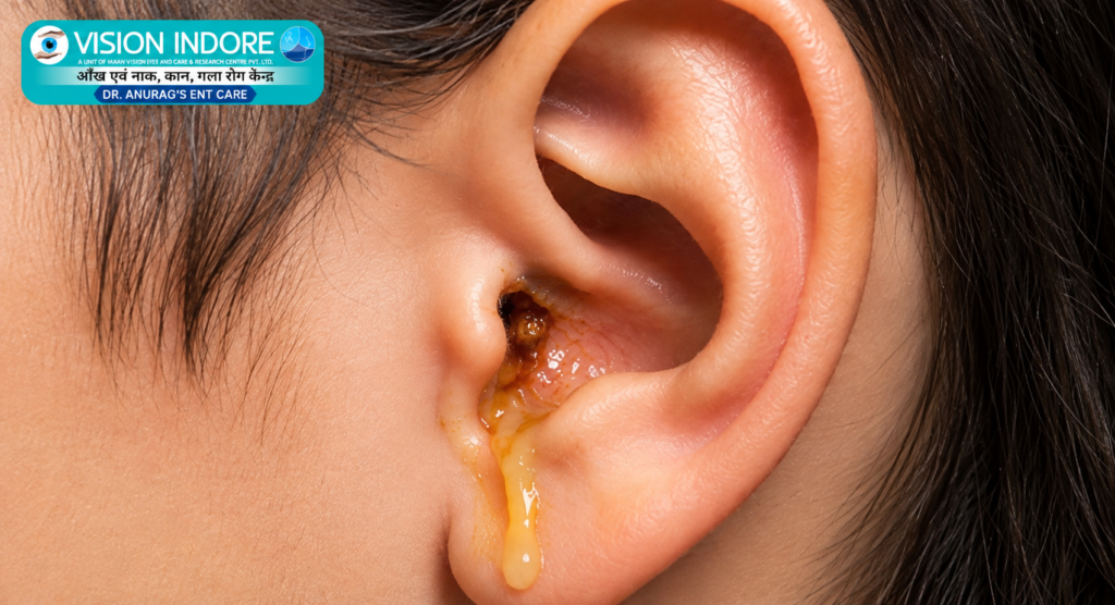 Ear Discharge Vision Indore 